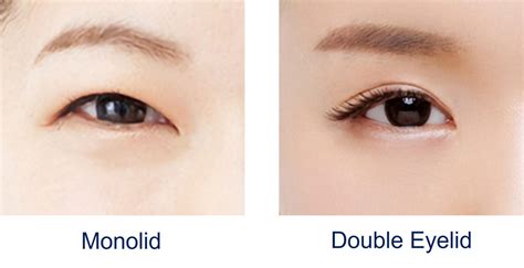 monolid ogen|Monolids vs. Double Eyelids: The Comprehensive Guide